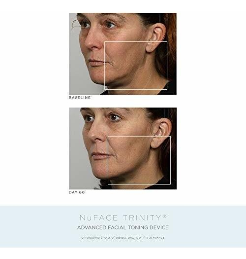 Salud y Equipamiento Médico - Kit Completo De Tonificacion Facial De Aniversario Nuface | 1