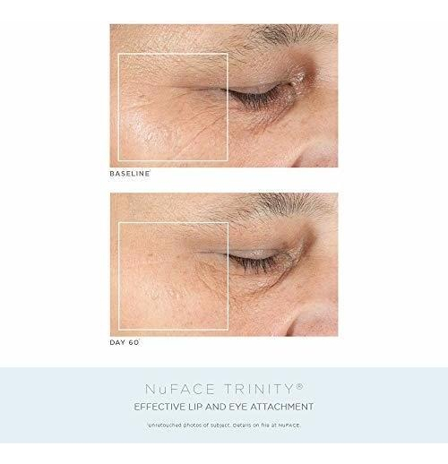 Salud y Equipamiento Médico - Kit Completo De Tonificacion Facial De Aniversario Nuface | 2