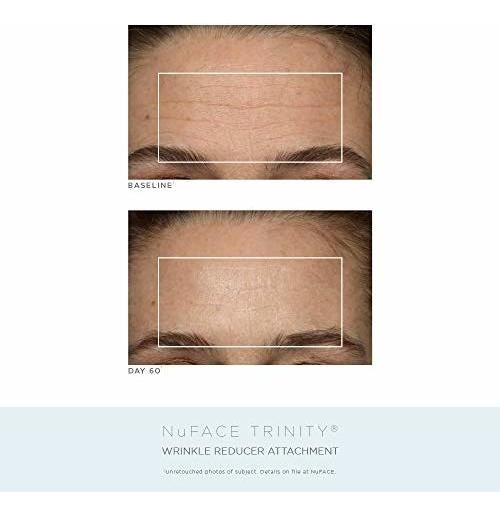 Salud y Equipamiento Médico - Kit Completo De Tonificacion Facial De Aniversario Nuface | 3