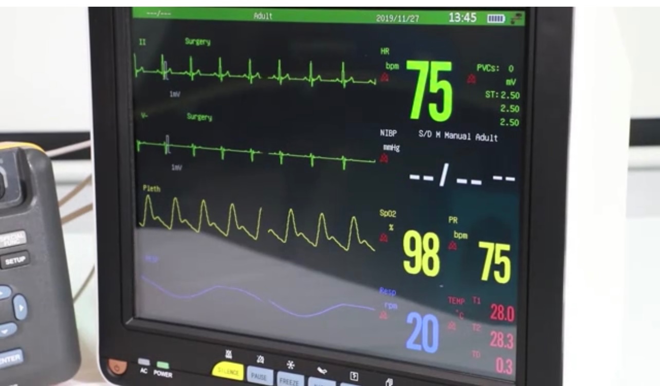 servicios profesionales - MONITOR DE SIGNOS VITALES  5