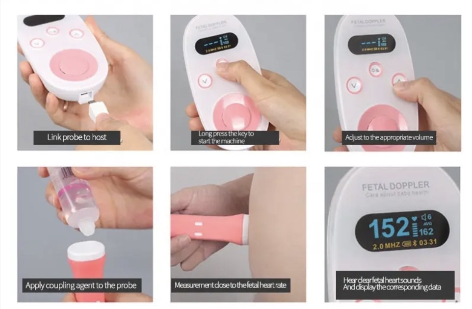 cuidado y nutricion - Doppler Detector ultrasónico frecuencia cardíaca fetal  1