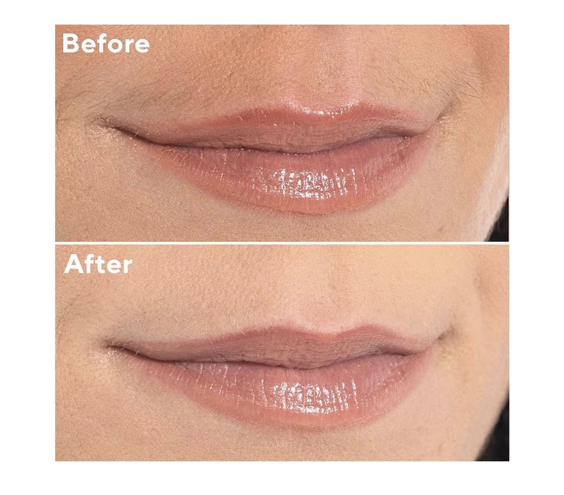 salud y belleza - Removedor de vello facial. 2