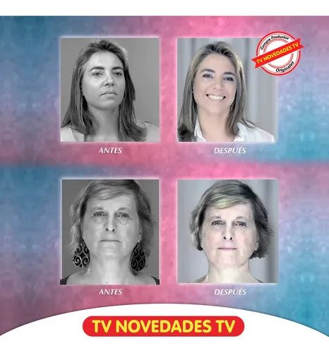 salud y belleza - Microdermoabrasión Rejuvenecedor Antiarrugas Diama 2